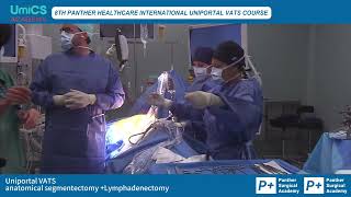 8th Panther Uniportal VATS MC live surgery Anatomical segmentocotmy  lymphadenectomy by Dr Diego [upl. by Haag407]