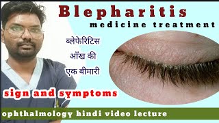 blepharitis treatment  blepharitis  treatment of blepharitis  blepharitis  hindiophthalmology [upl. by Higbee898]