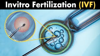 What is InVitro Fertilization  IVF [upl. by Nodab]