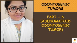 Adenomatoid Odontogenic Tumor AOT  Oral Pathology for BDSMDS students  Aspirants [upl. by Dnalhsa]