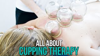 All About Cupping Therapy [upl. by Dett]