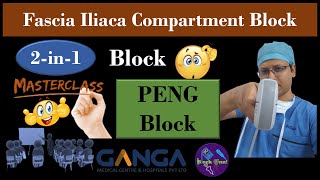 RA Masterclass Ultrasound Scanning Session  PENG Block  FICB  2in1 Block  DrTuhinM [upl. by Relda]