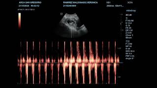 FRECUENCIA CARDIACA EMBRIONARIA [upl. by Dwinnell]