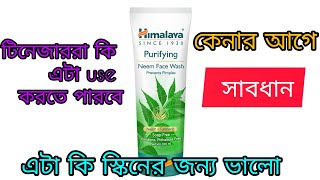 Himalaya neem face wash review ll কেনার আগে সাবধানll [upl. by Vokay25]