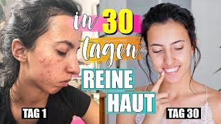 REINE HAUT in 30 TAGEN  Es hat geklappt 30 Tage OHNE MAKEUP [upl. by Montagu]