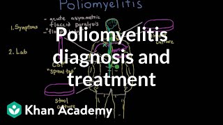 Poliomyelitis diagnosis and treatment  Infectious diseases  NCLEXRN  Khan Academy [upl. by Kaitlyn]