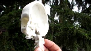 3D printed halfskull created from CT scan data [upl. by Etnemelc]