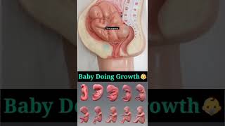 Twins baby growth [upl. by Materi]