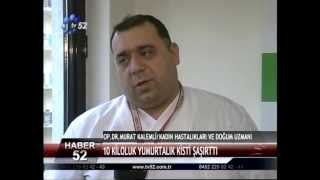 Op Dr Murat Kalemli  Dev Dermoid Kist [upl. by Parish]