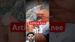 Artificial Knee  shorts knee kneepain trending [upl. by Atirec]