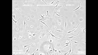 Cellular microenvironment modulates the galvanotaxis of brain tumor initiating cells [upl. by Latisha309]