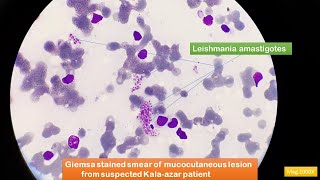 Leishmania amastigotes Microscopy [upl. by Rafaellle]