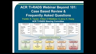 ACR TIRADS Webinar Part II Case Based Review amp Frequently Asked Questions [upl. by Airdnola]