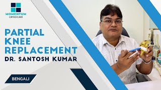 Partial Knee Replacement  By Dr Santosh Kumar Kolkata  in Bengali [upl. by Ahgiel]