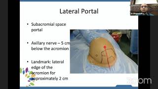 Basics of Shoulder Arthroscopy  Dr B Bhupesh Karthikeyan [upl. by Nema]