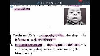 Endocrine pathology lecture 5 thyroid gland 1 [upl. by Airetal]