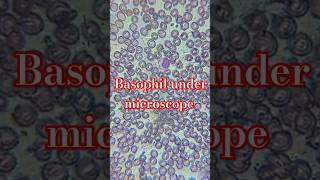 basophiliabloodtestsubscribeshortsvideoytshortspharmacymltdailyvlogcollegelifeviralvideo [upl. by Llehsim]