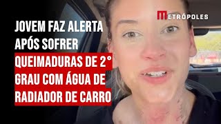 Jovem faz alerta após sofrer queimaduras de 2° grau com água de radiador de carro [upl. by Romelle488]