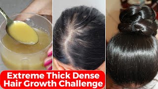 30 Days Extreme Thick Hair Growth ChallengeIncrease Hair Density amp thicknessपतले बालों को घना करे [upl. by Aleahc375]