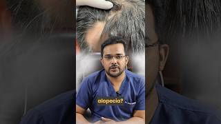 Is it possible to perform a hair transplant for scarring alopecia  Dr Alok Sahoo  alloroots [upl. by Nahem]