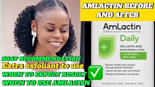 AMLACTIN BEFORE AND AFTER  HONEST TALK ABOUT AMLACTIN LOTION [upl. by Ocirred]