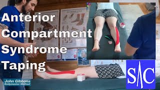 Easy guide on how to tape anterior compartment syndrome [upl. by Aicek]