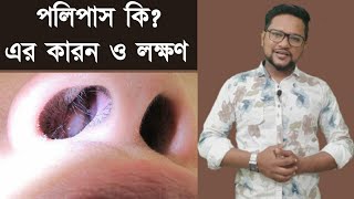 নাকের পলিপাস কি পলিপাসের কারন ও লক্ষণ। নাকের পলিপাস এর লক্ষণ। পলিপাস হলে কি কি সমস্যা হয়। পলিপাস [upl. by Aehsat937]