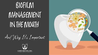 Dental and Oral Biofilm Management and Why Its Important [upl. by Aneeras]