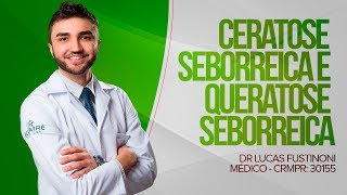 Tudo sobre Ceratose Seborreica e Queratose Seborreica  Dr Lucas Fustinoni  Médico  CRMPR 30155 [upl. by Elsy]