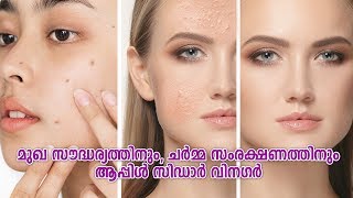 Apple cider vinegar for skin malayalam  മുഖ സൗന്ദര്യത്തിന് ആപ്പിൾ സിഡാർ വിനെഗർ [upl. by Barling]