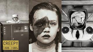 Eerie and Unsettling Medical Devices from the 1800s1900s  Bizarre Rare Historical Photos [upl. by Land93]