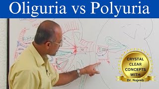 Oliguria vs Polyuria  Urine Output  Causes and Symptoms [upl. by Carmella]