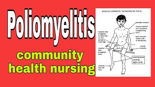 poliomyelitis in hindi  community health nursing  bsc nursing 2nd year [upl. by Ronym27]