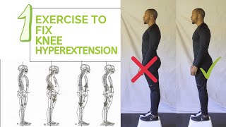 Knee Hyperextension Fix Hyperextended Knees [upl. by Nagol]