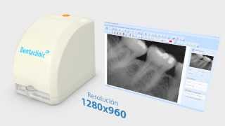 Digitalizador de Radiografías USB  Dentaclinic [upl. by Ellissa]