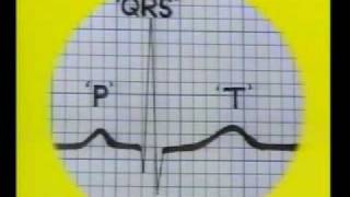 ECG reading Part1 [upl. by Ynnaf]