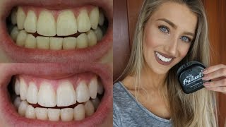 How I Whitened My Teeth At Home  Smile Brilliant Giveaway ♡ [upl. by Adina]