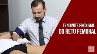 Tendinite Reto Femoral CUIDADO COM A ARTÉRIA [upl. by Ylyl607]