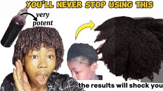 SHOCKING RESULT DO THIS ONCE A WEEK AND NOTICE MASSIVE HAIR GROWTH AND THICKNESS DIY FOR HAIR LOSS [upl. by Etnod804]