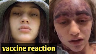 The womans condition deteriorated after the vaccine reaction she is struggling for life usa news [upl. by Aliled288]