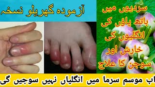 Hathon aur Paon ki Ungliyon ki sojan ka asan Fori ilaj  Finger swelling in winter  Chilblains [upl. by Wang588]