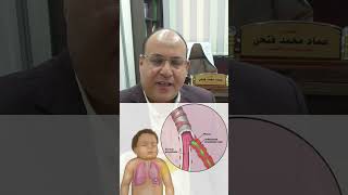 الالتهاب الشعيبي الدقيق في الأطفال أقل من سنتين يشبه حساسية الصدر Bronchiolitis [upl. by Ekud617]