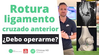 ✅ Operación ligamento cruzado anterior ⚽ ¿Debo operarme ❓ Clínica H3 [upl. by Fiorenze]