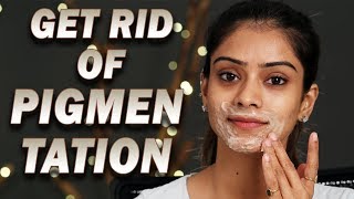 How To Get Rid Of Pigmentation  Home Remedy  Remove Pigmentation  Skincare Tutorial  Foxy [upl. by Skardol]