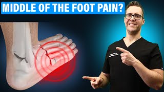 Lisfranc Injury Treatment amp Recovery Time Middle Foot Pain CURE [upl. by Ilana]