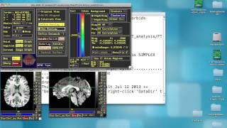 Functional Connectivity in AFNI Step 4 R to Z Transform [upl. by Llemrej915]