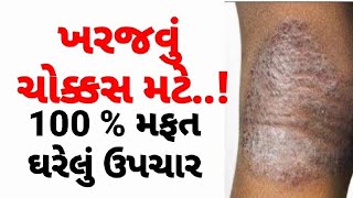 ખરજવું મટાડવા માટે  Eczema ka ilaj kharajvuDesiUpcharGujaratihelthtips GujaratiAyurvedicUpchar [upl. by Gracye]