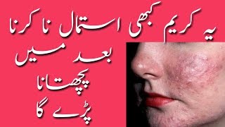 Pakistani Night Creams Side Effects  Dont Use These 3 Cream  DFL [upl. by Nollaf]