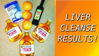 My Liver amp Gallbladder Cleanse Experience from Andreas Moritz [upl. by Eiclek886]