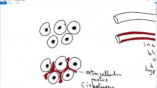 GENERAL PATHOLOGY 5  amyloidosis  structure  pathogenesis classification DR SAMEH GHAZY [upl. by Kaitlyn123]